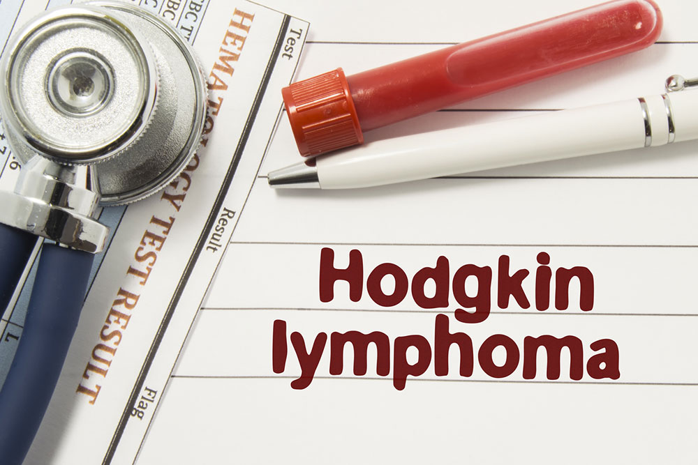 5 Risk Factors of Non-Hodgkin Lymphoma