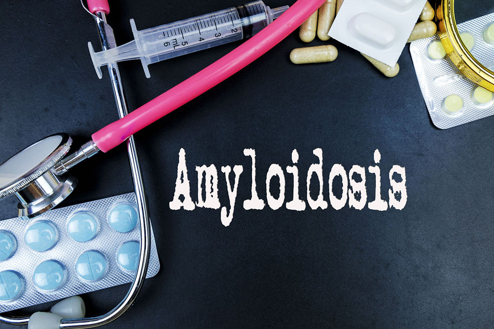 Signs and Symptoms Related to Amyloidosis