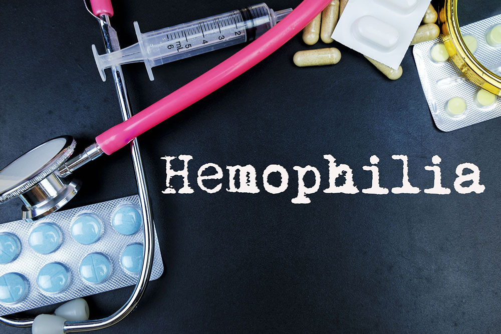 Treatment Methods for Hemophilia