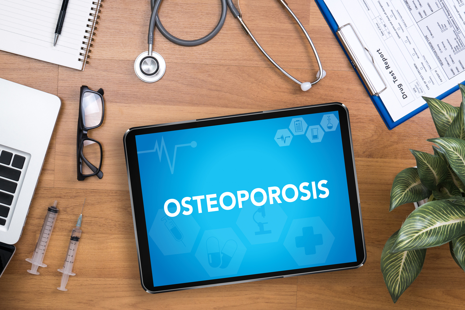 5 Early Symptoms of Osteoporosis